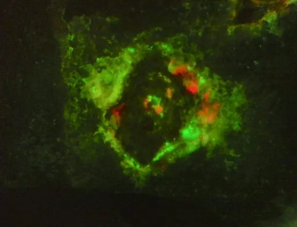 System in use in hospital environment